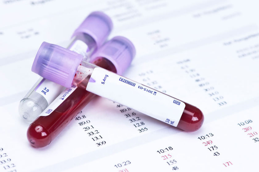 blood-test