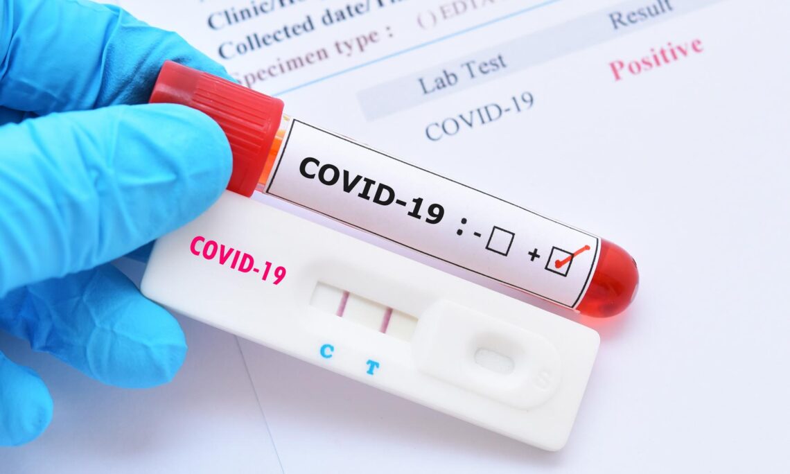 covid-test